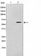 AF0669 staining LOVO by IF/ICC. The sample were fixed with PFA and permeabilized in 0.1% Triton X-100,then blocked in 10% serum for 45 minutes at 25¡ãC. The primary antibody was diluted at 1/200 and incubated with the sample for 1 hour at 37¡ãC. An  Alexa Fluor 594 conjugated goat anti-rabbit IgG (H+L) Ab, diluted at 1/600, was used as the secondary antibod