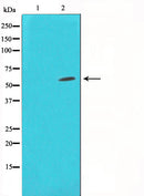 Western blot analysis on Jurkat cell lysate using HDAC1 Antibody,The lane on the left is treated with the antigen-specific peptide.