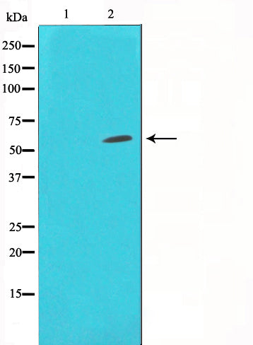 Western blot analysis on Jurkat cell lysate using HDAC1 Antibody,The lane on the left is treated with the antigen-specific peptide.
