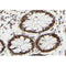 AF0178 at 1/100 staining human colon tissue sections by IHC-P. The tissue was formaldehyde fixed and a heat mediated antigen retrieval step in citrate buffer was performed. The tissue was then blocked and incubated with the antibody for 1.5 hours at 22¡ãC. An HRP conjugated goat anti-rabbit antibody was used as the secondary