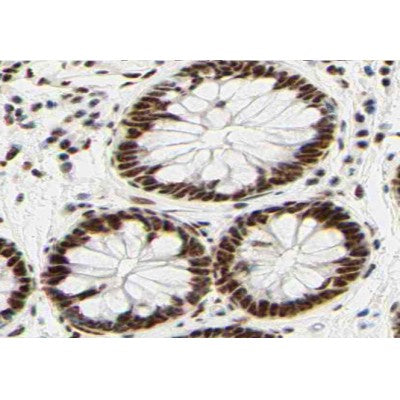 AF0178 at 1/100 staining human colon tissue sections by IHC-P. The tissue was formaldehyde fixed and a heat mediated antigen retrieval step in citrate buffer was performed. The tissue was then blocked and incubated with the antibody for 1.5 hours at 22¡ãC. An HRP conjugated goat anti-rabbit antibody was used as the secondary