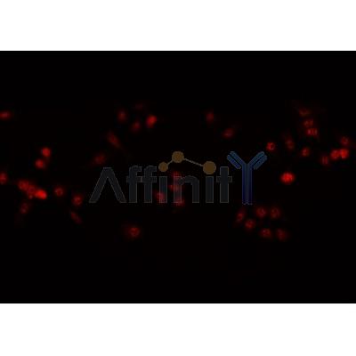 AF0178 staining  A-431 cells by IF/ICC. The sample were fixed with PFA and permeabilized in 0.1% Triton X-100,then blocked in 10% serum for 45 minutes at 25¡ãC. The primary antibody was diluted at 1/200 and incubated with the sample for 1 hour at 37¡ãC. An  Alexa Fluor 594 conjugated goat anti-rabbit IgG (H+L) antibody(Cat.