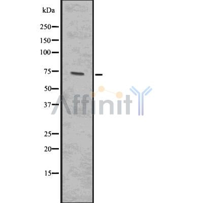 DF7537 at 1/100 staining Rat liver tissue by IHC-P. The sample was formaldehyde fixed and a heat mediated antigen retrieval step in citrate buffer was performed. The sample was then blocked and incubated with the antibody for 1.5 hours at 22¡ãC. An HRP conjugated goat anti-rabbit antibody was used as the secondary