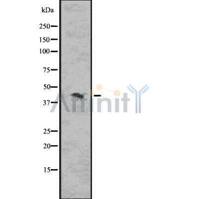 DF7538 staining COLO205 by IF/ICC. The sample were fixed with PFA and permeabilized in 0.1% Triton X-100,then blocked in 10% serum for 45 minutes at 25¡ãC. The primary antibody was diluted at 1/200 and incubated with the sample for 1 hour at 37¡ãC. An  Alexa Fluor 594 conjugated goat anti-rabbit IgG (H+L) Ab, diluted at 1/600, was used as the secondary antibod