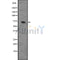 DF7539 at 1/100 staining Rat heart tissue by IHC-P. The sample was formaldehyde fixed and a heat mediated antigen retrieval step in citrate buffer was performed. The sample was then blocked and incubated with the antibody for 1.5 hours at 22¡ãC. An HRP conjugated goat anti-rabbit antibody was used as the secondary