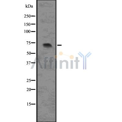 DF7539 at 1/100 staining Rat heart tissue by IHC-P. The sample was formaldehyde fixed and a heat mediated antigen retrieval step in citrate buffer was performed. The sample was then blocked and incubated with the antibody for 1.5 hours at 22¡ãC. An HRP conjugated goat anti-rabbit antibody was used as the secondary