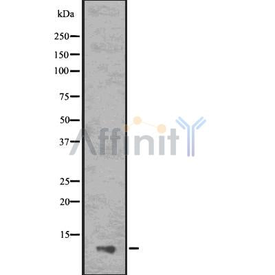 DF7540 at 1/100 staining Human liver tissue by IHC-P. The sample was formaldehyde fixed and a heat mediated antigen retrieval step in citrate buffer was performed. The sample was then blocked and incubated with the antibody for 1.5 hours at 22¡ãC. An HRP conjugated goat anti-rabbit antibody was used as the secondary