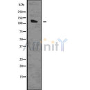 DF7542 at 1/100 staining Human kidney tissue by IHC-P. The sample was formaldehyde fixed and a heat mediated antigen retrieval step in citrate buffer was performed. The sample was then blocked and incubated with the antibody for 1.5 hours at 22¡ãC. An HRP conjugated goat anti-rabbit antibody was used as the secondary