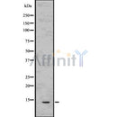 DF7544 at 1/100 staining Human gastric tissue by IHC-P. The sample was formaldehyde fixed and a heat mediated antigen retrieval step in citrate buffer was performed. The sample was then blocked and incubated with the antibody for 1.5 hours at 22¡ãC. An HRP conjugated goat anti-rabbit antibody was used as the secondary