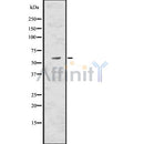 Western blot analysis of extracts from mouse kidney, using Catalase Antibody. Lane 1 was treated with the antigen-specific peptide.