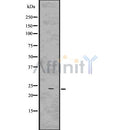DF7546 at 1/100 staining Mouse muscle tissue by IHC-P. The sample was formaldehyde fixed and a heat mediated antigen retrieval step in citrate buffer was performed. The sample was then blocked and incubated with the antibody for 1.5 hours at 22¡ãC. An HRP conjugated goat anti-rabbit antibody was used as the secondary