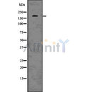 DF7553 staining HeLa cells by ICC/IF. Cells were fixed with PFA and permeabilized in 0.1% saponin prior to blocking in 10% serum for 45 minutes at 37¡ãC. The primary antibody was diluted 1/200 and incubated with the sample for 1 hour at 37¡ãC. A  Alexa Fluor 594 conjugated goat polyclonal to rabbit IgG (H+L), diluted 1/600 was used as secondary antibod