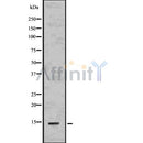 DF7554 at 1/100 staining Human melanoma tissue by IHC-P. The sample was formaldehyde fixed and a heat mediated antigen retrieval step in citrate buffer was performed. The sample was then blocked and incubated with the antibody for 1.5 hours at 22¡ãC. An HRP conjugated goat anti-rabbit antibody was used as the secondary