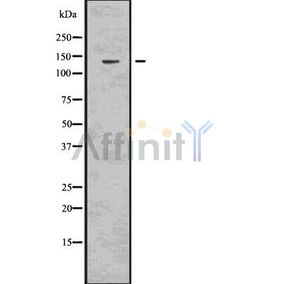 DF7556 at 1/100 staining Human prostate tissue by IHC-P. The sample was formaldehyde fixed and a heat mediated antigen retrieval step in citrate buffer was performed. The sample was then blocked and incubated with the antibody for 1.5 hours at 22¡ãC. An HRP conjugated goat anti-rabbit antibody was used as the secondary