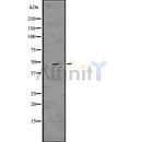 DF7557 at 1/100 staining Rat brain tissue by IHC-P. The sample was formaldehyde fixed and a heat mediated antigen retrieval step in citrate buffer was performed. The sample was then blocked and incubated with the antibody for 1.5 hours at 22¡ãC. An HRP conjugated goat anti-rabbit antibody was used as the secondary