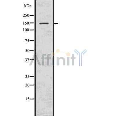 Western blot analysis of extracts from Mouse lung, using SMC3 Antibody. Lane 1 was treated with the blocking peptide.