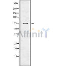 DF7559 staining HEPG2 cells by ICC/IF. Cells were fixed with PFA and permeabilized in 0.1% saponin prior to blocking in 10% serum for 45 minutes at 37¡ãC. The primary antibody was diluted 1/100 and incubated with the sample for 1 hour at 37¡ãC. A  Alexa Fluor 594 conjugated goat polyclonal to rabbit IgG (H+L), diluted 1/600 was used as secondary antibod