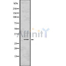 DF7560 at 1/100 staining Mouse testis tissue by IHC-P. The sample was formaldehyde fixed and a heat mediated antigen retrieval step in citrate buffer was performed. The sample was then blocked and incubated with the antibody for 1.5 hours at 22¡ãC. An HRP conjugated goat anti-rabbit antibody was used as the secondary