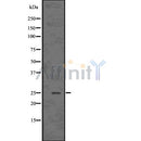 DF7562 at 1/100 staining Mouse spleen tissue by IHC-P. The sample was formaldehyde fixed and a heat mediated antigen retrieval step in citrate buffer was performed. The sample was then blocked and incubated with the antibody for 1.5 hours at 22¡ãC. An HRP conjugated goat anti-rabbit antibody was used as the secondary