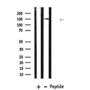 DF7566 at 1/100 staining Human liver tissue by IHC-P. The sample was formaldehyde fixed and a heat mediated antigen retrieval step in citrate buffer was performed. The sample was then blocked and incubated with the antibody for 1.5 hours at 22¡ãC. An HRP conjugated goat anti-rabbit antibody was used as the secondary