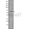 DF7567 at 1/100 staining Mouse lung tissue by IHC-P. The sample was formaldehyde fixed and a heat mediated antigen retrieval step in citrate buffer was performed. The sample was then blocked and incubated with the antibody for 1.5 hours at 22¡ãC. An HRP conjugated goat anti-rabbit antibody was used as the secondary