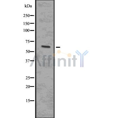 DF7567 at 1/100 staining Mouse lung tissue by IHC-P. The sample was formaldehyde fixed and a heat mediated antigen retrieval step in citrate buffer was performed. The sample was then blocked and incubated with the antibody for 1.5 hours at 22¡ãC. An HRP conjugated goat anti-rabbit antibody was used as the secondary