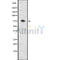DF7568 at 1/100 staining Mouse kidney tissue by IHC-P. The sample was formaldehyde fixed and a heat mediated antigen retrieval step in citrate buffer was performed. The sample was then blocked and incubated with the antibody for 1.5 hours at 22¡ãC. An HRP conjugated goat anti-rabbit antibody was used as the secondary