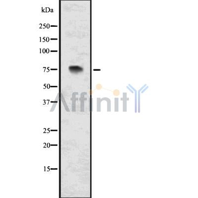 DF7568 at 1/100 staining Mouse kidney tissue by IHC-P. The sample was formaldehyde fixed and a heat mediated antigen retrieval step in citrate buffer was performed. The sample was then blocked and incubated with the antibody for 1.5 hours at 22¡ãC. An HRP conjugated goat anti-rabbit antibody was used as the secondary