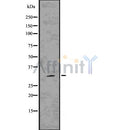 DF7569 at 1/100 staining Human gastric tissue by IHC-P. The sample was formaldehyde fixed and a heat mediated antigen retrieval step in citrate buffer was performed. The sample was then blocked and incubated with the antibody for 1.5 hours at 22¡ãC. An HRP conjugated goat anti-rabbit antibody was used as the secondary