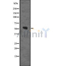 DF7570 staining HepG2 by IF/ICC. The sample were fixed with PFA and permeabilized in 0.1% Triton X-100,then blocked in 10% serum for 45 minutes at 25¡ãC. The primary antibody was diluted at 1/200 and incubated with the sample for 1 hour at 37¡ãC. An  Alexa Fluor 594 conjugated goat anti-rabbit IgG (H+L) Ab, diluted at 1/600, was used as the secondary antibod