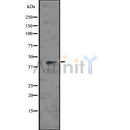 DF7571 at 1/100 staining Human Melanoma tissue by IHC-P. The sample was formaldehyde fixed and a heat mediated antigen retrieval step in citrate buffer was performed. The sample was then blocked and incubated with the antibody for 1.5 hours at 22¡ãC. An HRP conjugated goat anti-rabbit antibody was used as the secondary