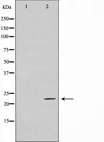 AF0624 staining HuvEc by IF/ICC. The sample were fixed with PFA and permeabilized in 0.1% Triton X-100,then blocked in 10% serum for 45 minutes at 25¡ãC. The primary antibody was diluted at 1/200 and incubated with the sample for 1 hour at 37¡ãC. An  Alexa Fluor 594 conjugated goat anti-rabbit IgG (H+L) Ab, diluted at 1/600, was used as the secondary antibod