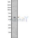DF7572 at 1/100 staining Human pancreas tissue by IHC-P. The sample was formaldehyde fixed and a heat mediated antigen retrieval step in citrate buffer was performed. The sample was then blocked and incubated with the antibody for 1.5 hours at 22¡ãC. An HRP conjugated goat anti-rabbit antibody was used as the secondary