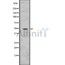 DF7574 at 1/100 staining Rat brain tissue by IHC-P. The sample was formaldehyde fixed and a heat mediated antigen retrieval step in citrate buffer was performed. The sample was then blocked and incubated with the antibody for 1.5 hours at 22¡ãC. An HRP conjugated goat anti-rabbit antibody was used as the secondary
