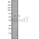 DF7575 at 1/100 staining Rat lung tissue by IHC-P. The sample was formaldehyde fixed and a heat mediated antigen retrieval step in citrate buffer was performed. The sample was then blocked and incubated with the antibody for 1.5 hours at 22¡ãC. An HRP conjugated goat anti-rabbit antibody was used as the secondary