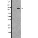 DF7576 staining Hela by IF/ICC. The sample were fixed with PFA and permeabilized in 0.1% Triton X-100,then blocked in 10% serum for 45 minutes at 25¡ãC. The primary antibody was diluted at 1/200 and incubated with the sample for 1 hour at 37¡ãC. An  Alexa Fluor 594 conjugated goat anti-rabbit IgG (H+L) Ab, diluted at 1/600, was used as the secondary antibod