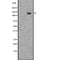 DF7576 staining Hela by IF/ICC. The sample were fixed with PFA and permeabilized in 0.1% Triton X-100,then blocked in 10% serum for 45 minutes at 25¡ãC. The primary antibody was diluted at 1/200 and incubated with the sample for 1 hour at 37¡ãC. An  Alexa Fluor 594 conjugated goat anti-rabbit IgG (H+L) Ab, diluted at 1/600, was used as the secondary antibod