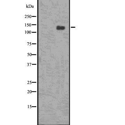 DF7576 staining Hela by IF/ICC. The sample were fixed with PFA and permeabilized in 0.1% Triton X-100,then blocked in 10% serum for 45 minutes at 25¡ãC. The primary antibody was diluted at 1/200 and incubated with the sample for 1 hour at 37¡ãC. An  Alexa Fluor 594 conjugated goat anti-rabbit IgG (H+L) Ab, diluted at 1/600, was used as the secondary antibod