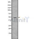 DF7578 at 1/100 staining Human brain cancer tissue by IHC-P. The sample was formaldehyde fixed and a heat mediated antigen retrieval step in citrate buffer was performed. The sample was then blocked and incubated with the antibody for 1.5 hours at 22¡ãC. An HRP conjugated goat anti-rabbit antibody was used as the secondary
