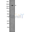 DF7581 at 1/100 staining Mouse colon tissue by IHC-P. The sample was formaldehyde fixed and a heat mediated antigen retrieval step in citrate buffer was performed. The sample was then blocked and incubated with the antibody for 1.5 hours at 22¡ãC. An HRP conjugated goat anti-rabbit antibody was used as the secondary