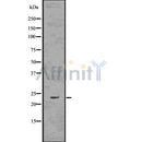 DF7582 at 1/100 staining Human kidney tissue by IHC-P. The sample was formaldehyde fixed and a heat mediated antigen retrieval step in citrate buffer was performed. The sample was then blocked and incubated with the antibody for 1.5 hours at 22¡ãC. An HRP conjugated goat anti-rabbit antibody was used as the secondary