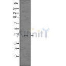 Western blot analysis of extracts from Mouse brain, using CD11c Antibody. The lane on the left was treated with blocking peptide.
