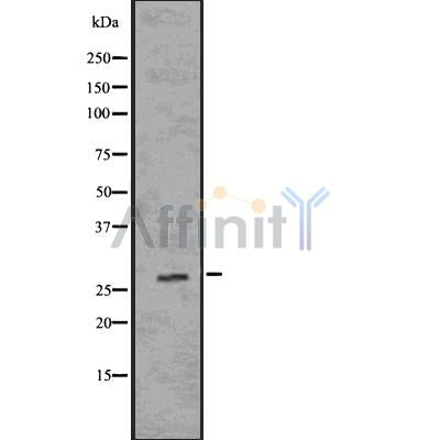 DF7586 at 1/100 staining Human gastric tissue by IHC-P. The sample was formaldehyde fixed and a heat mediated antigen retrieval step in citrate buffer was performed. The sample was then blocked and incubated with the antibody for 1.5 hours at 22¡ãC. An HRP conjugated goat anti-rabbit antibody was used as the secondary