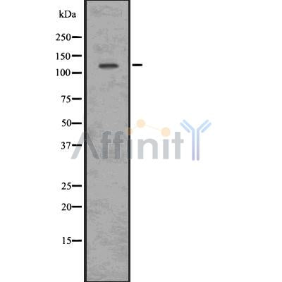DF7587 at 1/100 staining Mouse kidney tissue by IHC-P. The sample was formaldehyde fixed and a heat mediated antigen retrieval step in citrate buffer was performed. The sample was then blocked and incubated with the antibody for 1.5 hours at 22¡ãC. An HRP conjugated goat anti-rabbit antibody was used as the secondary