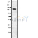 DF7588 at 1/100 staining Mouse kidney tissue by IHC-P. The sample was formaldehyde fixed and a heat mediated antigen retrieval step in citrate buffer was performed. The sample was then blocked and incubated with the antibody for 1.5 hours at 22¡ãC. An HRP conjugated goat anti-rabbit antibody was used as the secondary
