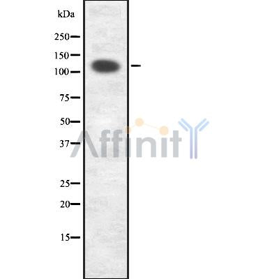 DF7588 at 1/100 staining Mouse kidney tissue by IHC-P. The sample was formaldehyde fixed and a heat mediated antigen retrieval step in citrate buffer was performed. The sample was then blocked and incubated with the antibody for 1.5 hours at 22¡ãC. An HRP conjugated goat anti-rabbit antibody was used as the secondary
