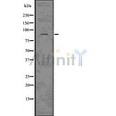 DF7590 at 1/100 staining Human brain cancer tissue by IHC-P. The sample was formaldehyde fixed and a heat mediated antigen retrieval step in citrate buffer was performed. The sample was then blocked and incubated with the antibody for 1.5 hours at 22¡ãC. An HRP conjugated goat anti-rabbit antibody was used as the secondary