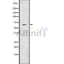 DF7591 at 1/100 staining Mouse muscle tissue by IHC-P. The sample was formaldehyde fixed and a heat mediated antigen retrieval step in citrate buffer was performed. The sample was then blocked and incubated with the antibody for 1.5 hours at 22¡ãC. An HRP conjugated goat anti-rabbit antibody was used as the secondary