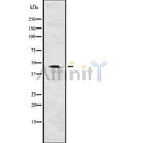 Acetylated ?-Tubulin Regulated by N-Acetyl-Seryl-Aspartyl-Lysyl-Proline (Ac-SDKP) Exerts the Anti-fibrotic Effect in Rat Lung Fibrosis Induced by Silica W Xiaojun, L Yan, X Hong, Z Xianghong…  Scientific …, 2016  ncbi.nlm.nih.gov