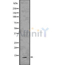 DF7596 at 1/100 staining Human lymph node tissue by IHC-P. The sample was formaldehyde fixed and a heat mediated antigen retrieval step in citrate buffer was performed. The sample was then blocked and incubated with the antibody for 1.5 hours at 22¡ãC. An HRP conjugated goat anti-rabbit antibody was used as the secondary
